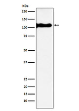 Anti-KA1 Rabbit Monoclonal Antibody Boster Bio