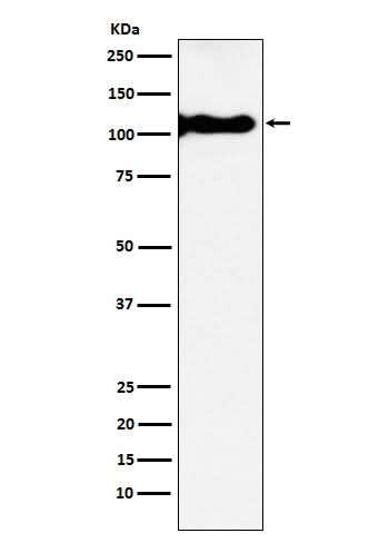 Anti-KA1 Rabbit Monoclonal Antibody Boster Bio