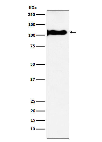 Anti-KA1 Rabbit Monoclonal Antibody Boster Bio