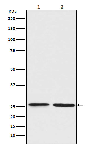 Anti-BNIP1 Rabbit Monoclonal Antibody Boster Bio