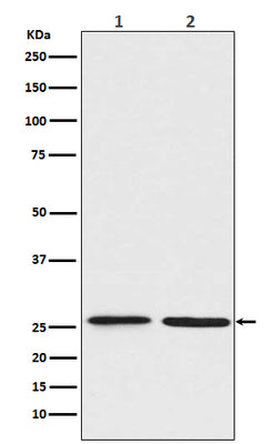 Anti-BNIP1 Rabbit Monoclonal Antibody Boster Bio
