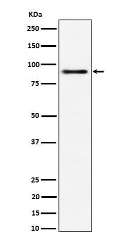 Anti-ACAP2 Rabbit Monoclonal Antibody Boster Bio