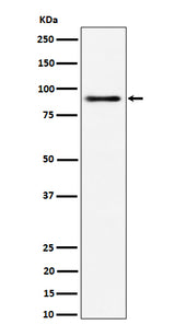 Anti-ACAP2 Rabbit Monoclonal Antibody Boster Bio