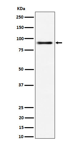 Anti-ACAP2 Rabbit Monoclonal Antibody Boster Bio