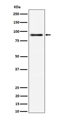 Anti-ACAP2 Rabbit Monoclonal Antibody Boster Bio