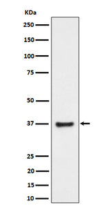 Anti-RNF115 Rabbit Monoclonal Antibody Boster Bio