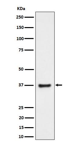 Anti-RNF115 Rabbit Monoclonal Antibody Boster Bio