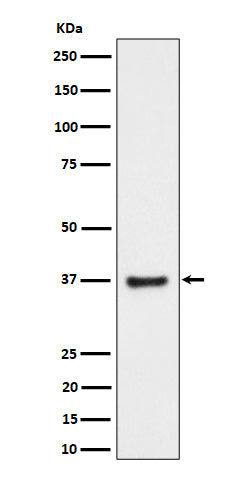 Anti-RNF115 Rabbit Monoclonal Antibody Boster Bio