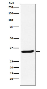 Anti-POLR2C Rabbit Monoclonal Antibody Boster Bio