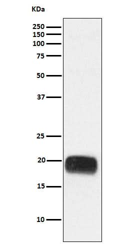 Anti-Mammaglobin A Rabbit Monoclonal Antibody Boster Bio