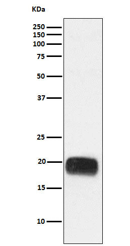 Anti-Mammaglobin A Rabbit Monoclonal Antibody Boster Bio