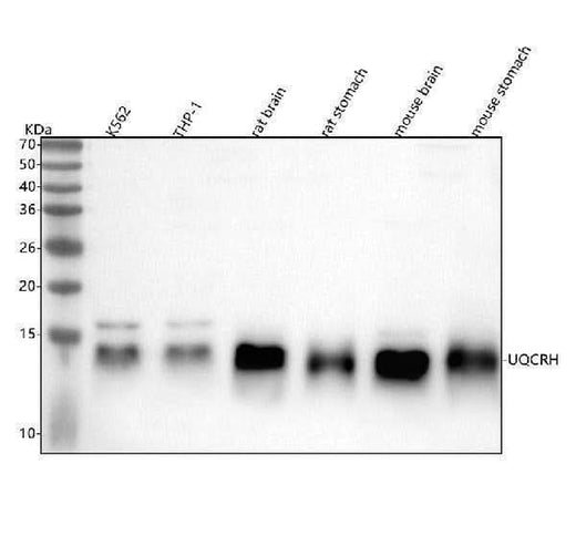 Anti-UQCRH Rabbit Monoclonal Antibody Boster Bio