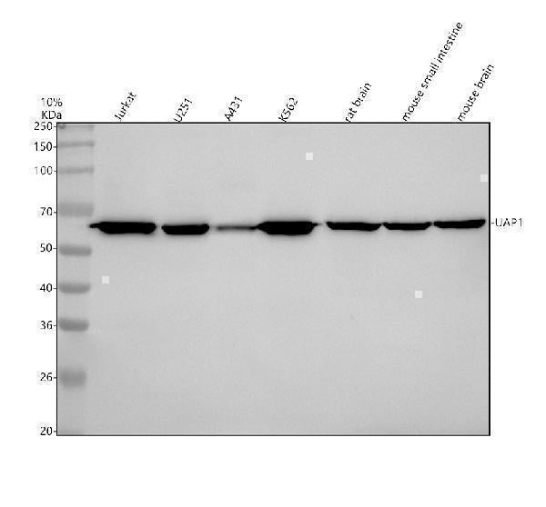 Anti-UAP1 Rabbit Monoclonal Antibody Boster Bio