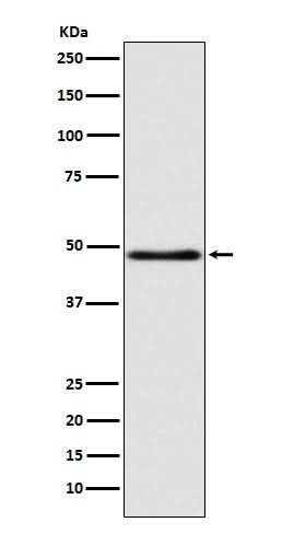 Anti-GCET1 SERPINA9 Rabbit Monoclonal Antibody Boster Bio