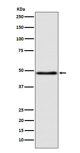Anti-GCET1 SERPINA9 Rabbit Monoclonal Antibody Boster Bio