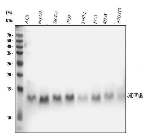 Anti-NDUFAB1 Rabbit Monoclonal Antibody Boster Bio