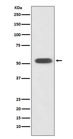Anti-HSPA14 Rabbit Monoclonal Antibody Boster Bio