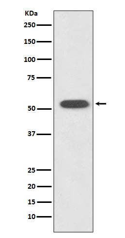 Anti-HSPA14 Rabbit Monoclonal Antibody Boster Bio