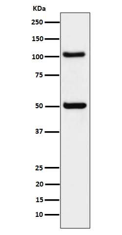 Anti-ORP1 Rabbit Monoclonal Antibody Boster Bio