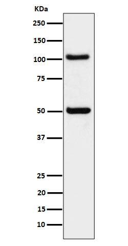 Anti-ORP1 Rabbit Monoclonal Antibody Boster Bio