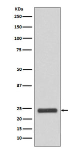 Anti-MRRF Rabbit Monoclonal Antibody Boster Bio