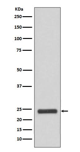 Anti-MRRF Rabbit Monoclonal Antibody Boster Bio