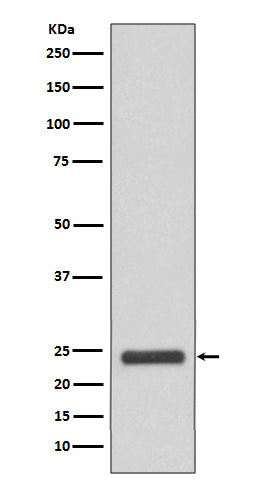 Anti-MRRF Rabbit Monoclonal Antibody Boster Bio