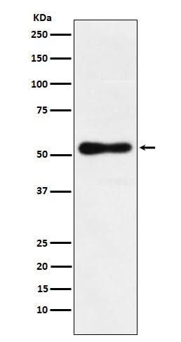 Anti-ROR beta Rabbit Monoclonal Antibody Boster Bio