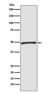 Anti-Atg4C Rabbit Monoclonal Antibody Boster Bio
