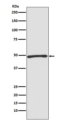 Anti-Atg4C Rabbit Monoclonal Antibody Boster Bio