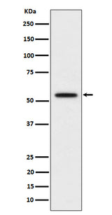 Anti-p60 katanin Rabbit Monoclonal Antibody Boster Bio