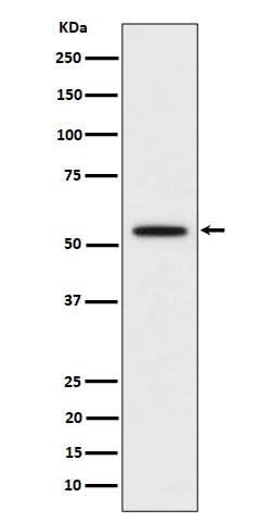 Anti-p60 katanin Rabbit Monoclonal Antibody Boster Bio