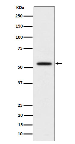 Anti-p60 katanin Rabbit Monoclonal Antibody Boster Bio