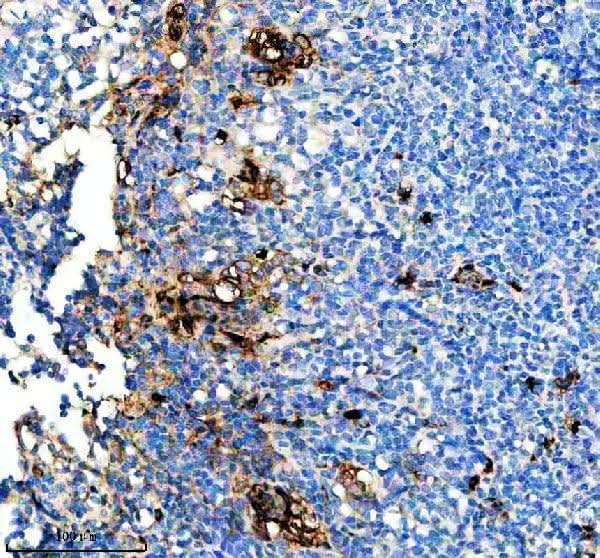Anti-CD163L1 Rabbit Monoclonal Antibody Boster Bio