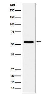 Anti-TOE1 Rabbit Monoclonal Antibody Boster Bio