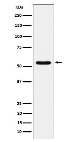Anti-TOE1 Rabbit Monoclonal Antibody Boster Bio
