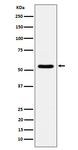 Anti-TOE1 Rabbit Monoclonal Antibody Boster Bio