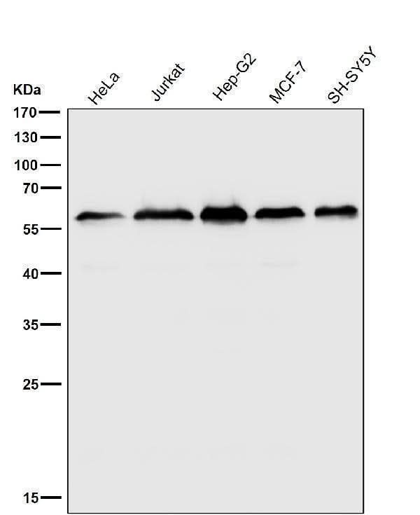 Anti-KLC3 Rabbit Monoclonal Antibody Boster Bio