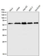 Anti-KLC3 Rabbit Monoclonal Antibody Boster Bio