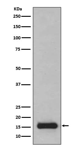Anti-PFDN5 Rabbit Monoclonal Antibody Boster Bio