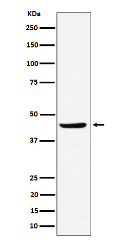 Anti-NDRG3 Rabbit Monoclonal Antibody Boster Bio