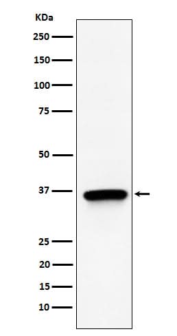 Anti-TIMM50 Rabbit Monoclonal Antibody Boster Bio