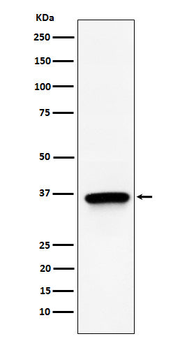 Anti-TIMM50 Rabbit Monoclonal Antibody Boster Bio