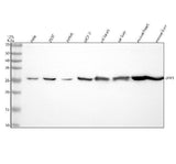 Anti-UPP1 Rabbit Monoclonal Antibody Boster Bio