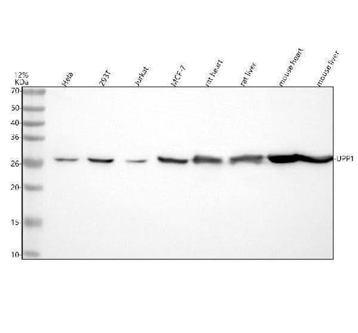 Anti-UPP1 Rabbit Monoclonal Antibody Boster Bio