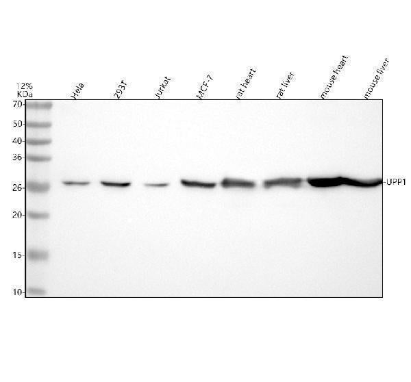Anti-UPP1 Rabbit Monoclonal Antibody Boster Bio