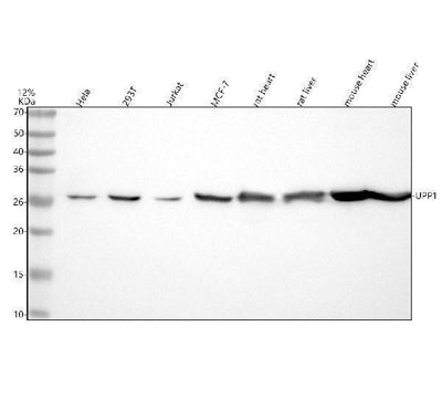 Anti-UPP1 Rabbit Monoclonal Antibody Boster Bio