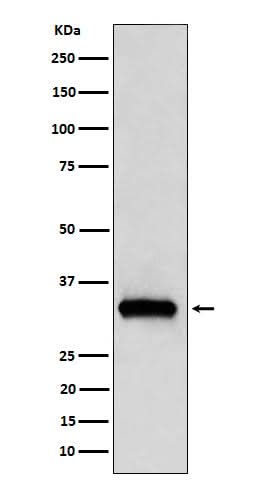 Anti-NDUFAF1 Rabbit Monoclonal Antibody Boster Bio