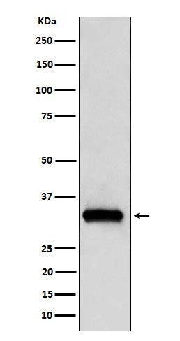 Anti-NDUFAF1 Rabbit Monoclonal Antibody Boster Bio