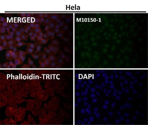 Anti-WDR4 Rabbit Monoclonal Antibody Boster Bio
